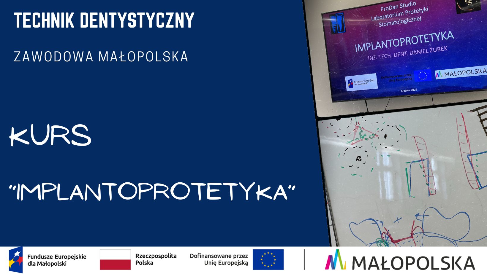 Grafika promująca kurs „Implantoprotetyka” dla słuchaczy zawodu technik dentystyczny. Po lewej stronie granatowe tło z białymi napisami: „Technik Dentystyczny”, „Zawodowa Małopolska” oraz „Kurs 'Implantoprotetyka'”. Na dole logotypy Funduszy Europejskich, Rzeczypospolitej Polskiej, Unii Europejskiej i Województwa Małopolskiego. Po prawej zdjęcie ekranu z prezentacją o implantoprotetyce i fragment tablicy z kolorowymi szkicami.