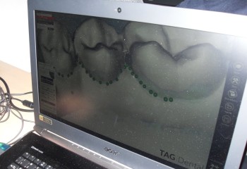 Komputer z włączonym specjalistycznym oprogramowaniem