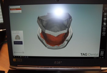 Komputerowe projektowanie prac protetycznych