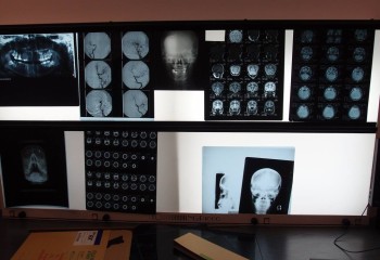 Szkolna pracownia RTG