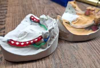 Zdjęcie przedstawia narzędzia niezbędne do wykonywania prac protetycznych