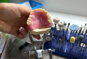 Zdjęcie przedstawia wykonaną pracę protetyczną