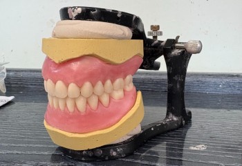 Zdjęcie przedstawia wykonaną pracę protetyczną